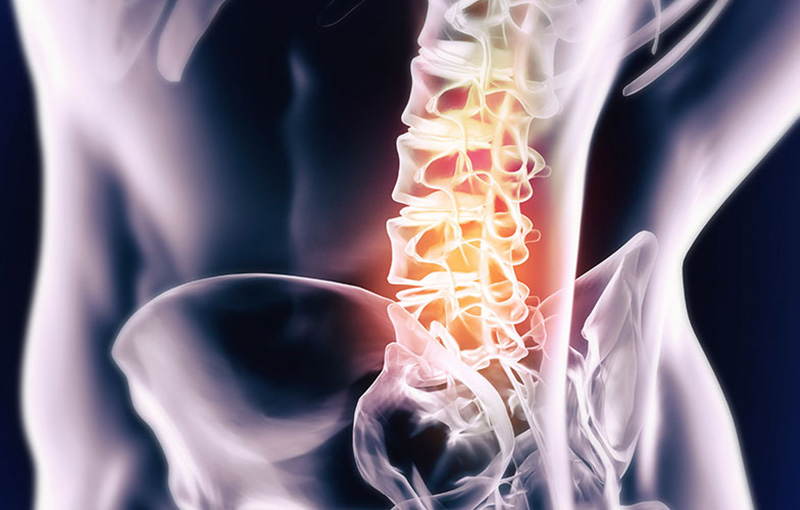 Spinal Decompression